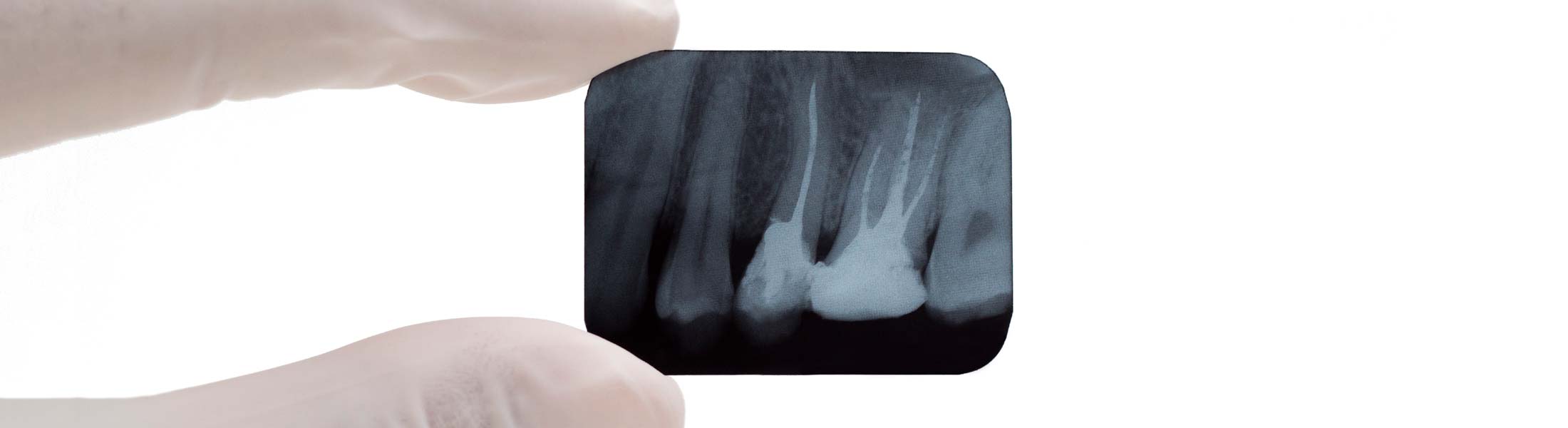 Endodontie